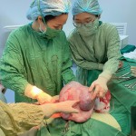 Phẫu thuật khối u nang buồng trứng nặng 6,5kg tại Bệnh viện Sản Nhi Bắc Giang