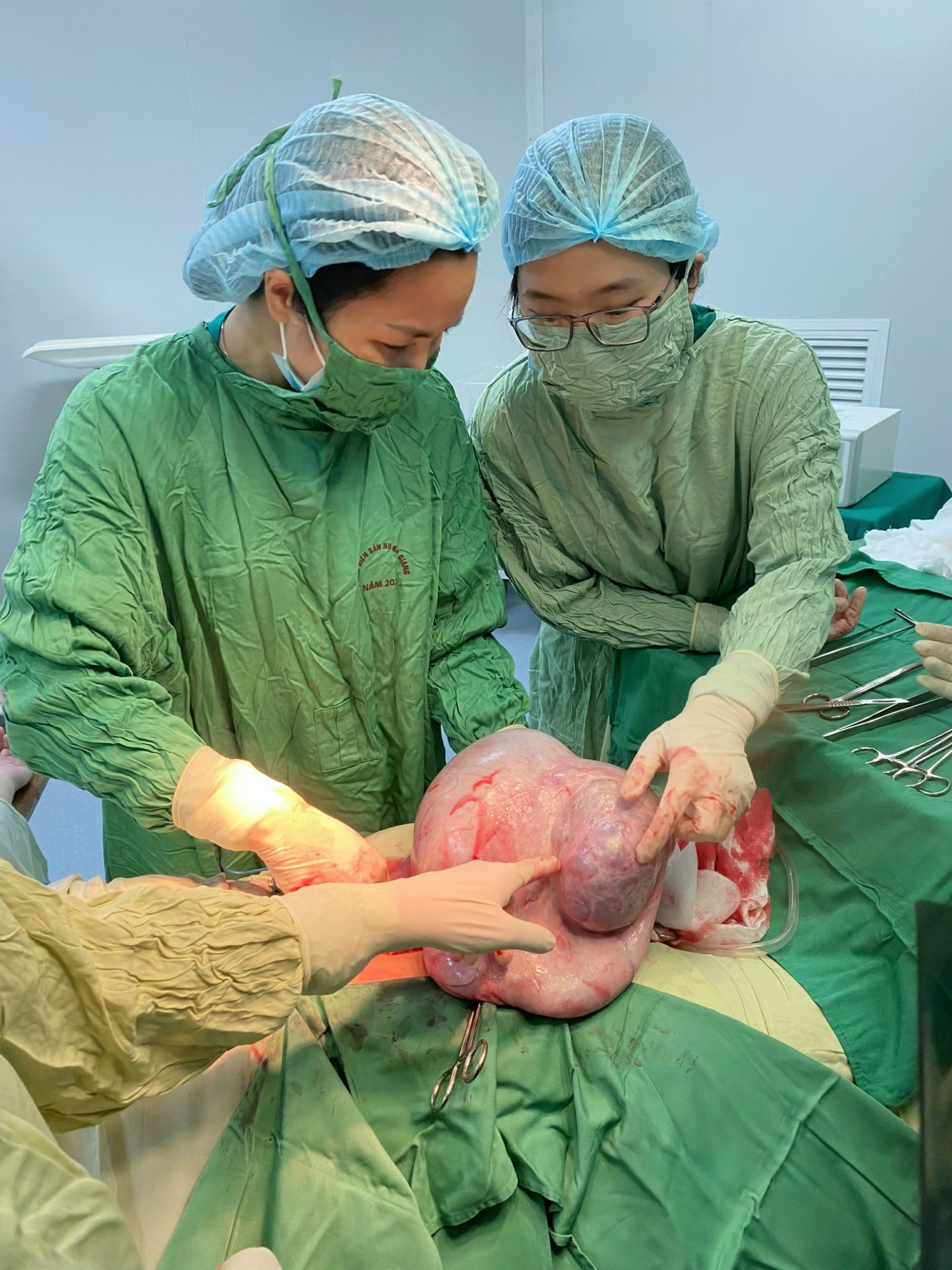 Phẫu thuật khối u nang buồng trứng nặng 6,5kg tại Bệnh viện Sản Nhi Bắc Giang
