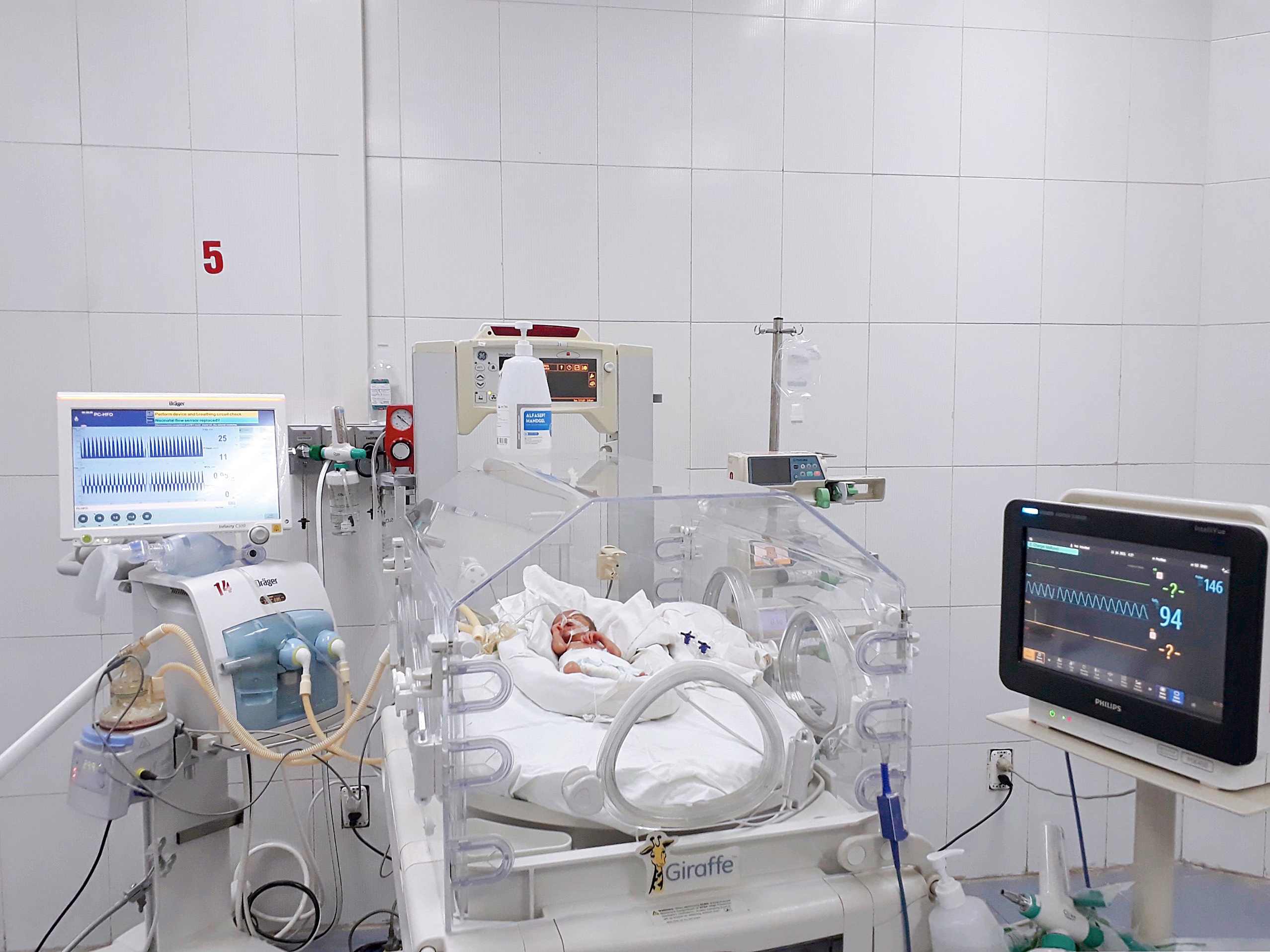 Bệnh viện Sản Nhi Bắc Giang cứu sống bé trai sinh non tháng ở tuần 31 thai kỳ bị suy hô hấp nặng trong Khu Cách ly