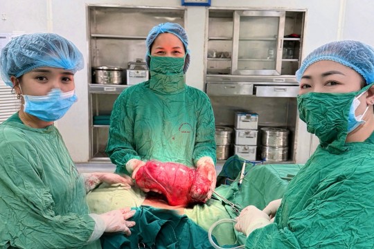 Phẫu thuật khối u xơ tử cung nặng 4,3kg tại Bệnh viện Sản Nhi Bắc Giang