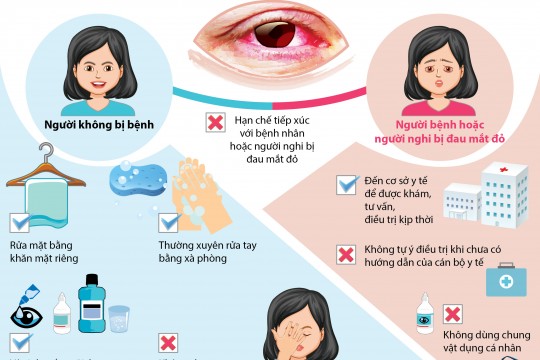 HƯỚNG DẪN CÁCH PHÒNG BỆNH ĐAU MẮT ĐỎ