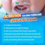 DÍNH THẮNG LƯỠI: NHẬN BIẾT SỚM, CAN THIỆP KỊP THỜI