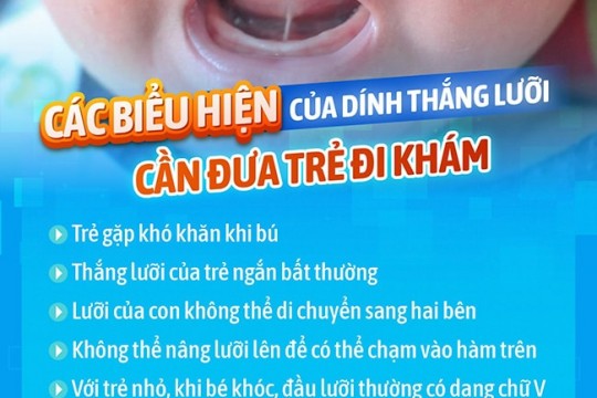 DÍNH THẮNG LƯỠI: NHẬN BIẾT SỚM, CAN THIỆP KỊP THỜI